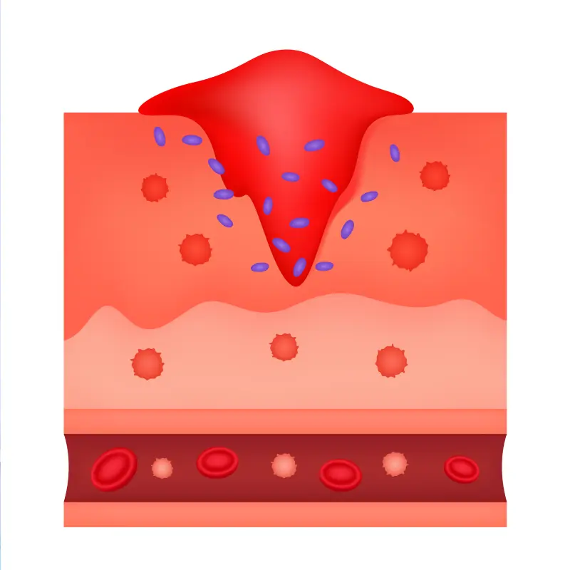 «Рани та рановий процес. Сучасне лікування ран»
