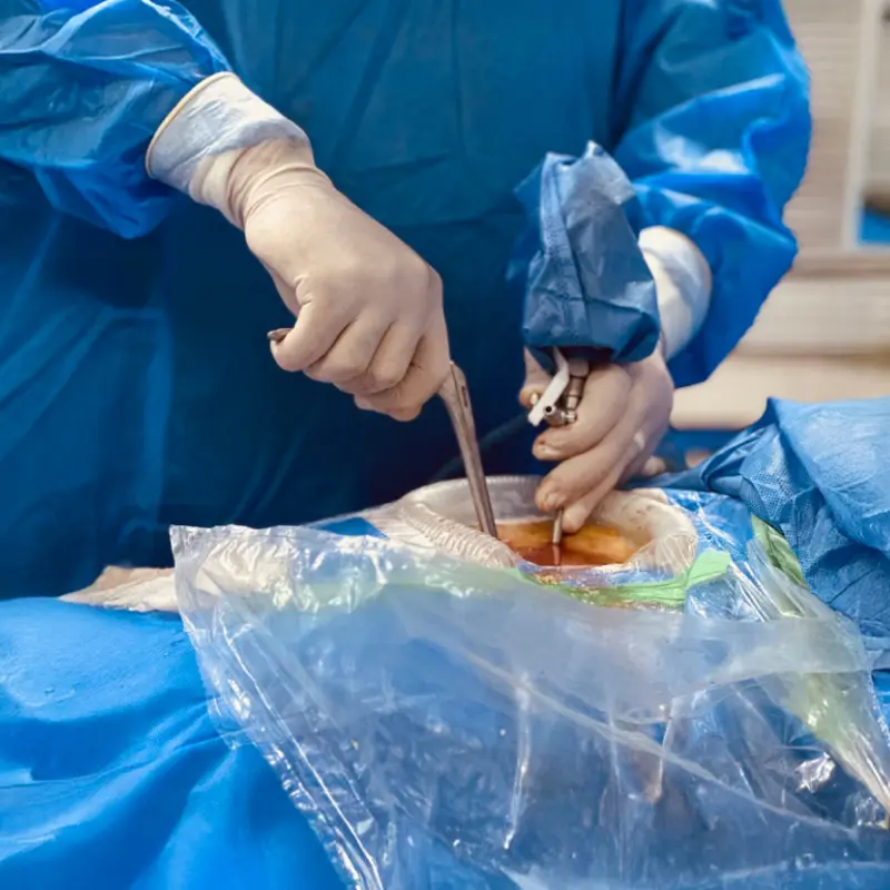 Малоінвазивна хірургія хребта: техніка UBE з використанням перкутанних систем