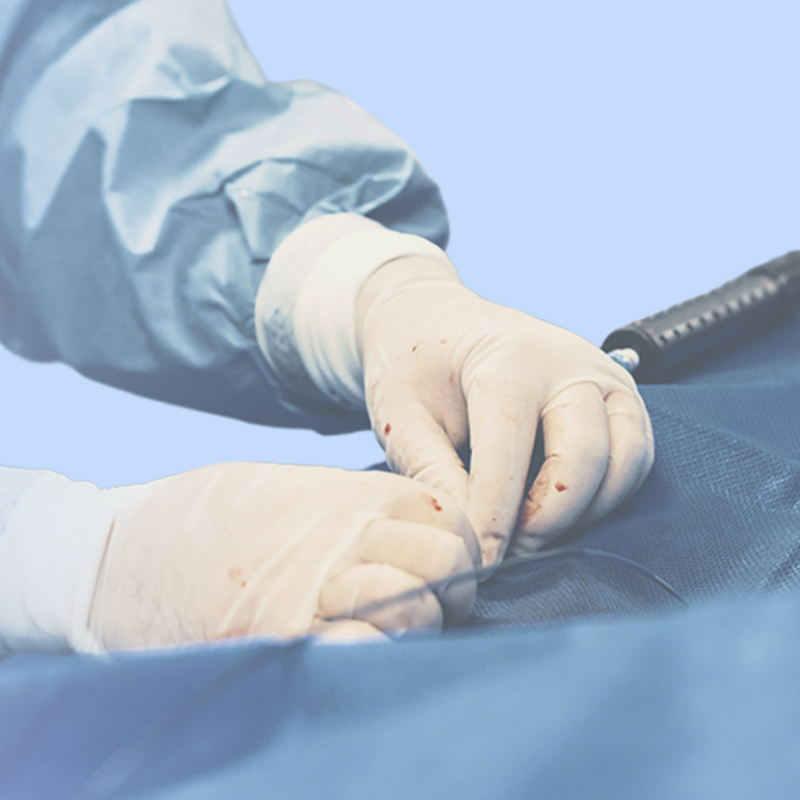 Інтервенційне лікування пацієнта з мультифокальним атеросклерозом